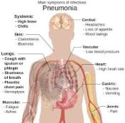 obat pneumonia